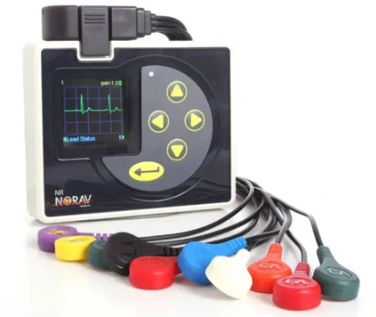 ECG Monitors &amp; Arrhythmia: Detecting Irregular Heartbeats Early